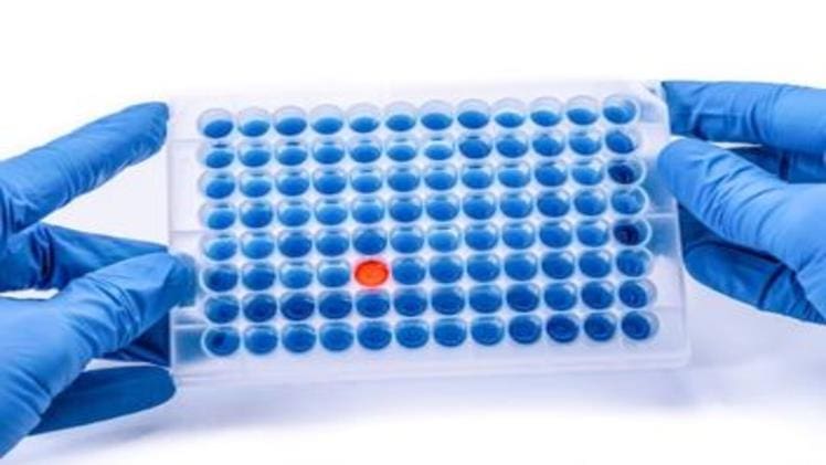 Guide To Elisa Kit Testing For Covid-19 And Benefits Of Custom Elisa Kits