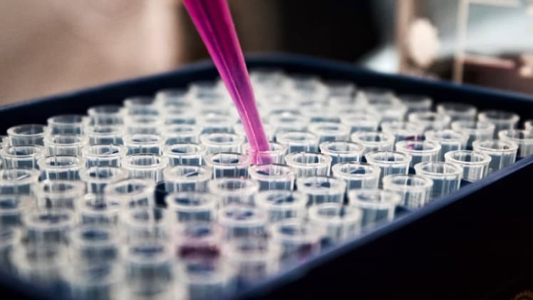 From An Anesthetic To A Silent Killer: The Notorious Story Of Trichloroethylene